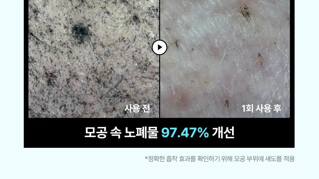 [피지흡착/모공쿨링] 메디힐 바이오 세컨덤 마스크 1매 3종 (마데카소사이드, PDRN, 히알루론산) 상세페이지 7